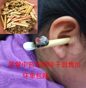 Ear Moxibustion Device: Reed Pipe Ear Moxa Head, Row Ear Moxa Box, Stick, Instrument, Special Pot for Home Portable Moxibustion Tools