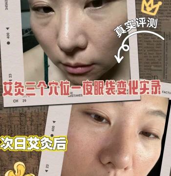 All girls, do moxibustion together! A face as clear as a mirror reflects the brilliance of your internal organs.