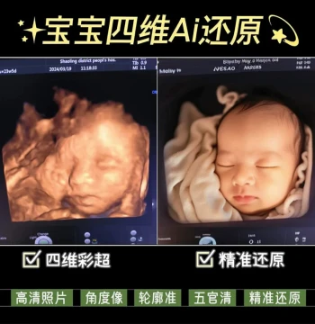 Baby 3D/4D AI Photo Ultrasound Restoration Deep HD Appearance Look 5D Infant Fetus HD Imaging
