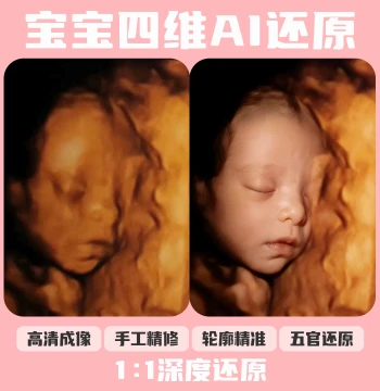Baby 4D AI Photo 3D 5D 4D Ultrasound Restoration Prediction of Fetal Appearance HD Infant Imaging