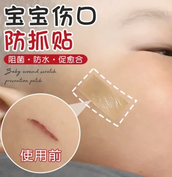 Baby Wound Anti-Scratch Gel Patch, Scar Sheet, Artificial Skin, Invisible Transparent Hemostatic Vaccine Patch, Sun Protection