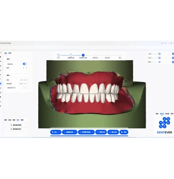 [Occlusal Reconstruction] DENTEVER DESIGN Dental CAD Platform