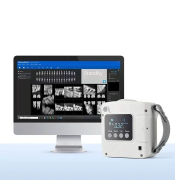 Dental X-Ray Machine by Runyes - Mobile High-Frequency Ray Unit with Sensor