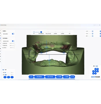 [Average Model] DENTEVER DESIGN Dental CAD Platform