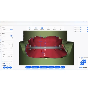 [Average Wax Rim] DENTEVER DESIGN Oral CAD Platform