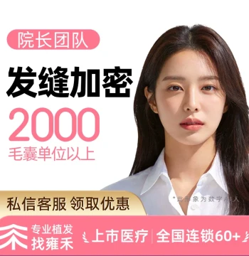 Yonghe Hair Transplant: Top Scalp Density Enhancement (2000+ Units Fixed Price)