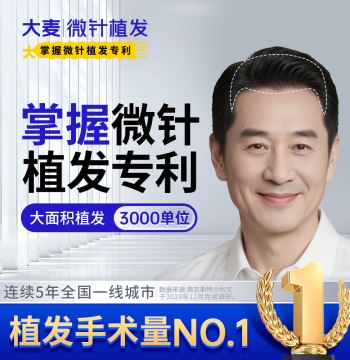 [Daimai Holds Micro-Needle Hair Transplant Patent] U-Shape Large-Area Hair Loss | 3000 Grafts for Thinning Crown