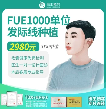 Beisheng Hair Transplant in Shenzhen and Guangzhou – 1000 Graft Micro-Needle Hairline and Crown Density Enhancement