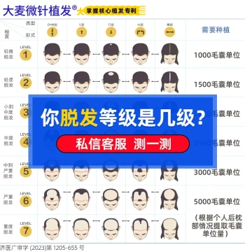 [Daimai Microneedle Hair Transplant] Hairline Planting for Hair Loss, Thinning [Nationwide Chain]