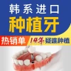 [All-Inclusive Flat Rate] Single Imported Dental Implant | Includes Free Cleaning, Abutment, Fixture, and Crown