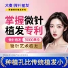 [Daimai Holds Micro-Needle Hair Transplant Patent] Micro-Needle Artistic Hairline Planting, 3000 Grafts for Hair Loss Treatment
